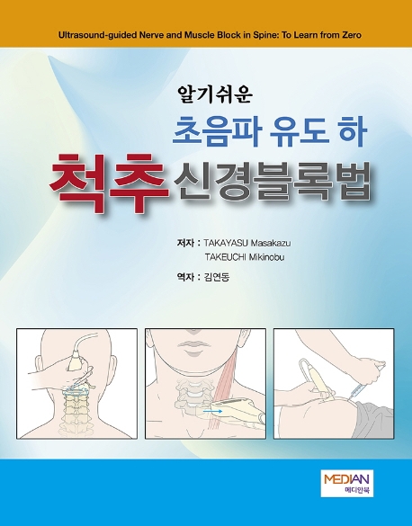 알기쉬운 초음파 유도하 척추신경블록법